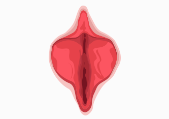 전체비대 소음순