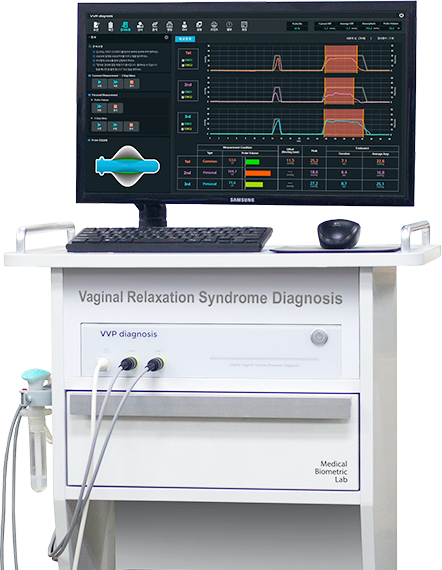 질 축소술 장비