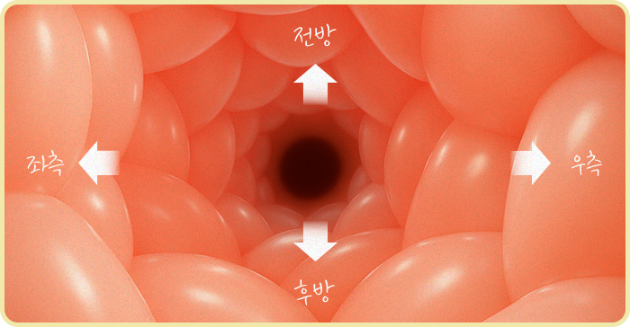 프리샤산부인과의 섬세한 봉합술